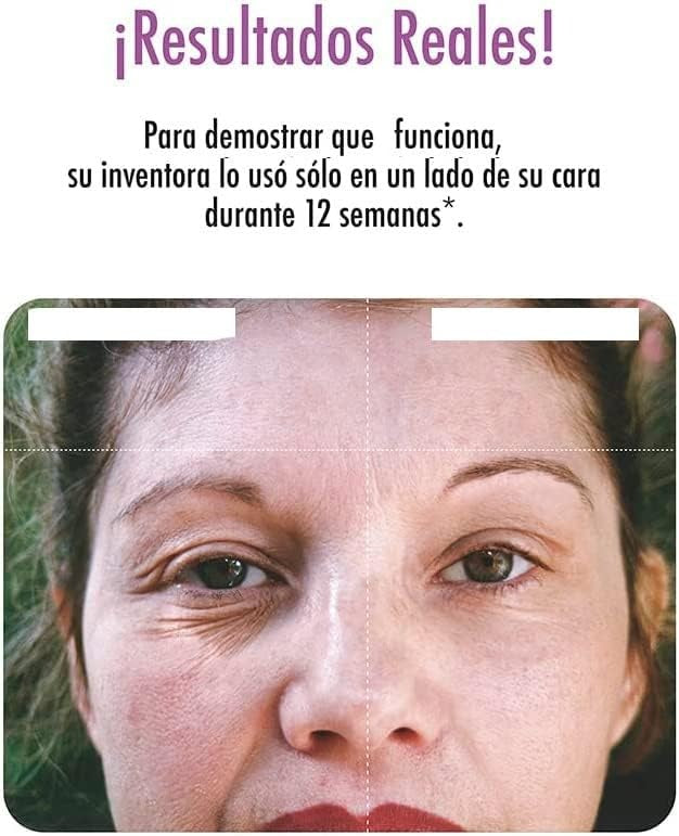 Dermawand Pro™: Rejuvenecimiento Visible en Cada Sesión