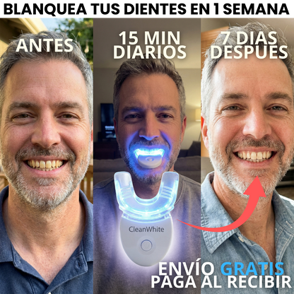 Clean White: Blanqueador dental