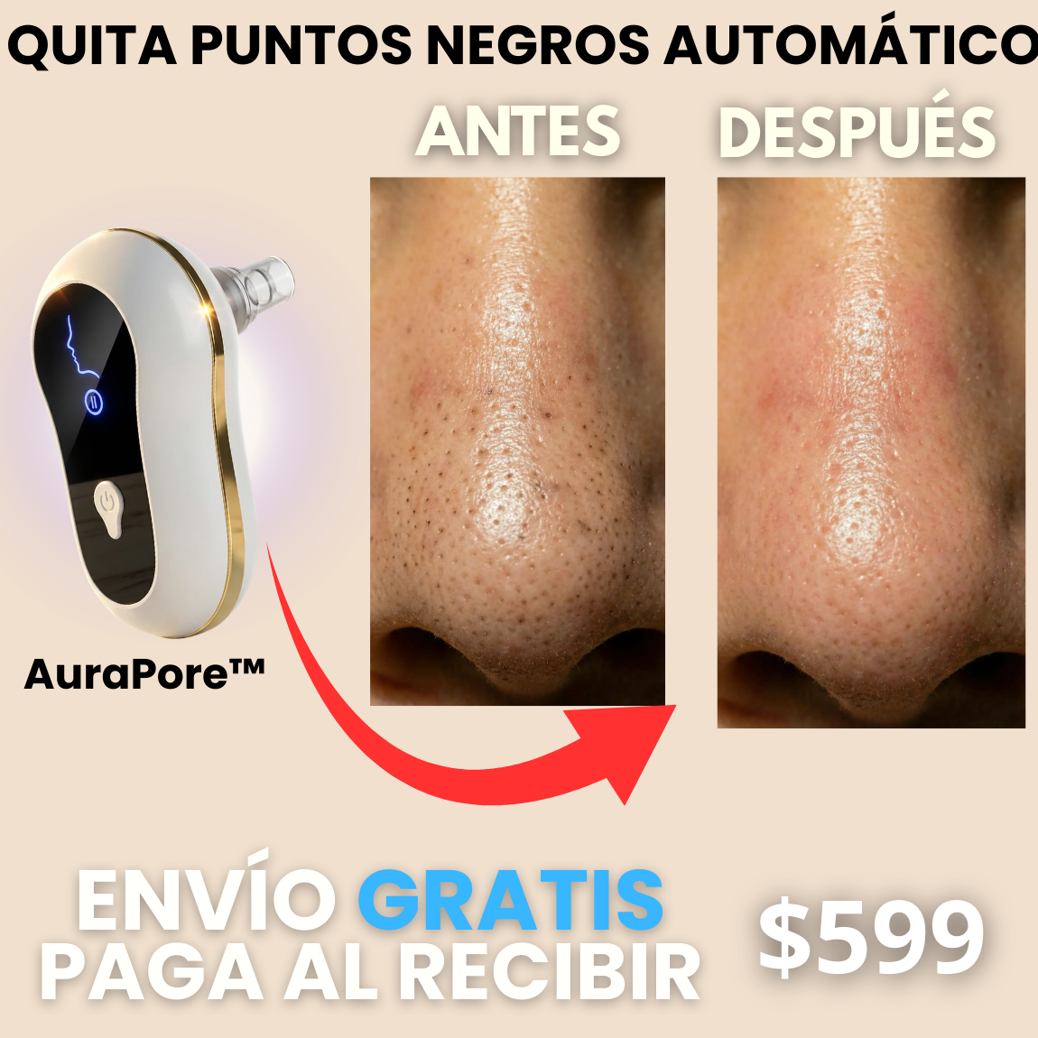 AuraPore™: Remueve puntos al instante
