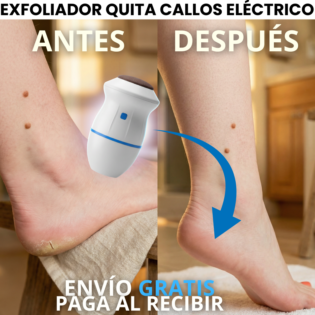 CallusPro™: Exfoliante quita callos eléctrico.